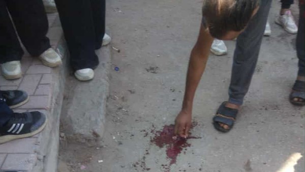 مشاجرة دموية في مدرسة المعصرة تثير مطالبات بتدخل وزارة التعليم لوقف إهمال الإشراف