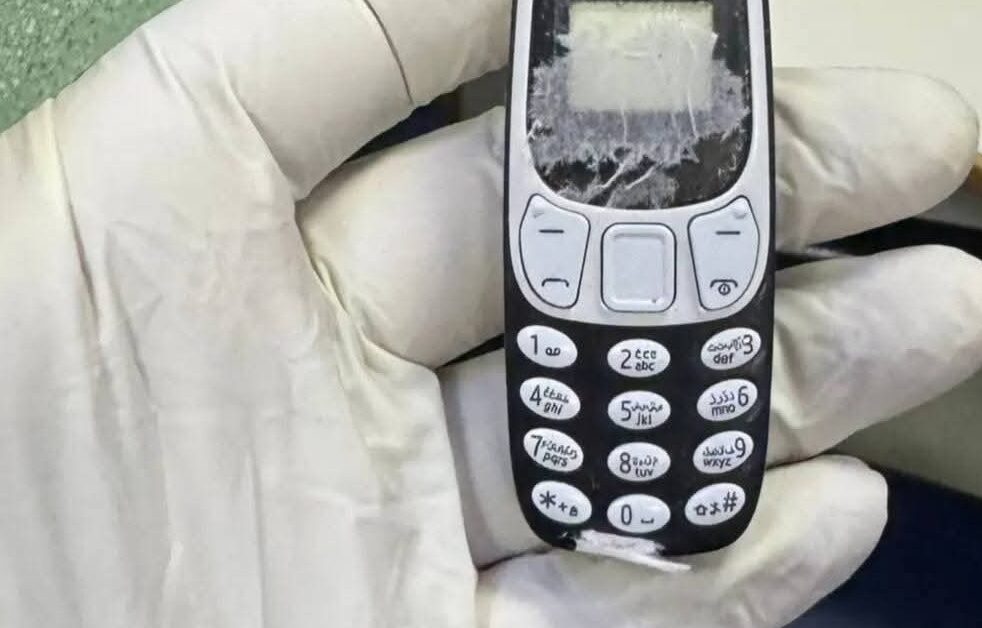كان خارج الخدمـة.. إخراج هاتف محمول من بطن مريض بعد 11 شهرًا من ابتلاعه في جامعة المنصورة